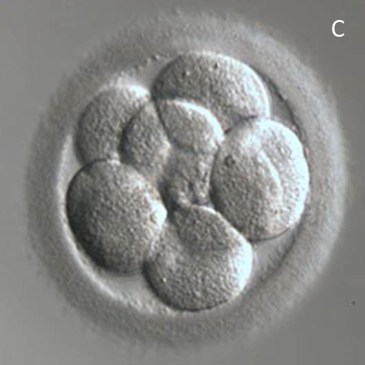 Voorbeeld van een 3 dagen oud embryo na invriezen en ontdooien