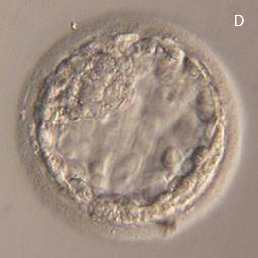 Voorbeeld van een 5 dagen oud embryo na invriezen en ontdooien